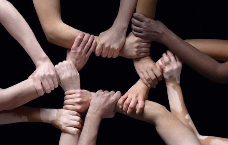 interlinking arms of people of all colors and races to represent diversity and inclusion in the hybrid work world